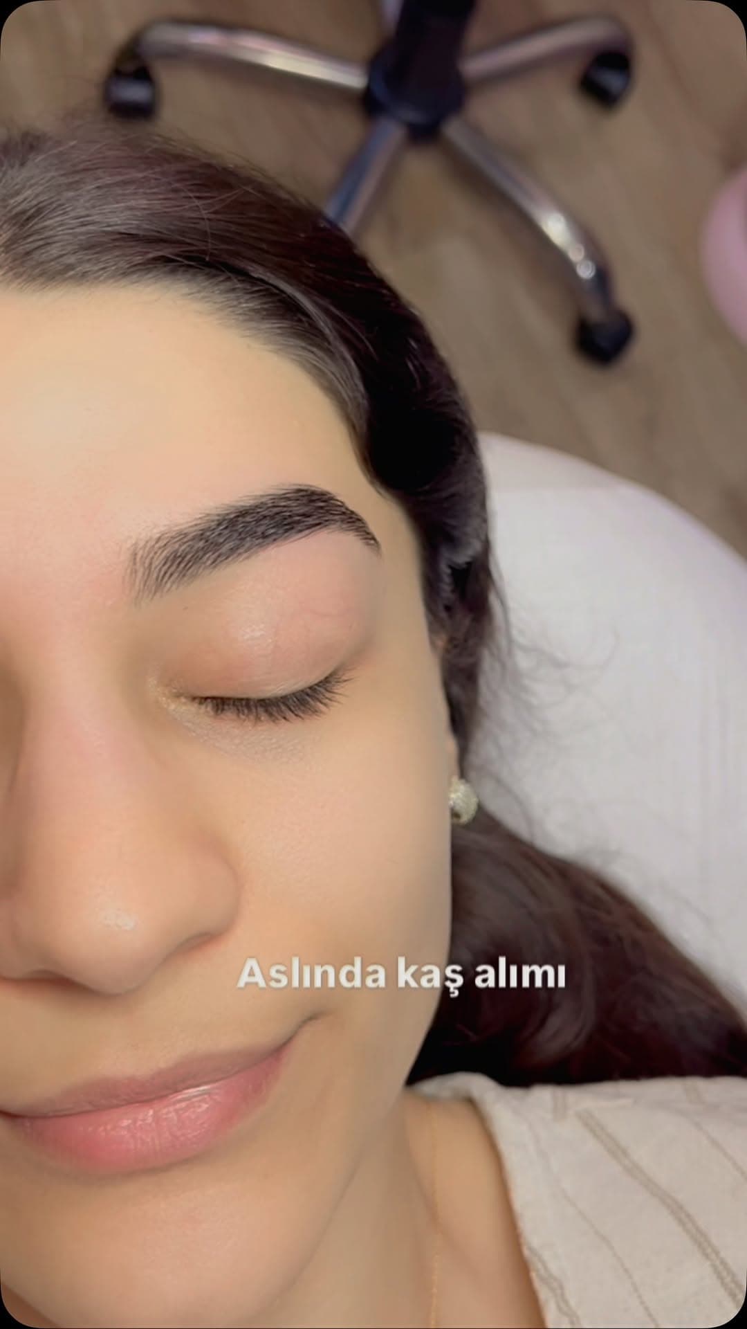 Kaş alımı sonrası doğal görünüm
